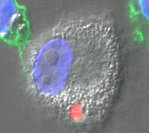 A Macrophage cell stained with DAPI, so that it's nucleaus (the DNA in particular) are blue.  Additionally, smaller T-Cells are close by the Macrophage..  Their nuclei are blue, too but their membranes are green and you can see that the smaller cell membranes reach out to touch the Macrophage membranes with skinny projections.  